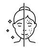 acne solutions